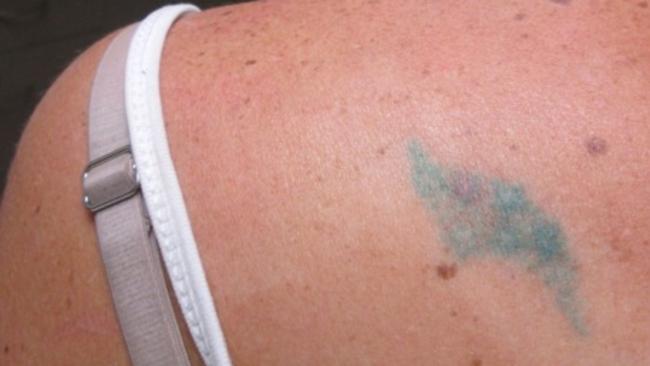 Laser experts say green ink can be very difficult to remove. Picture: Supplied