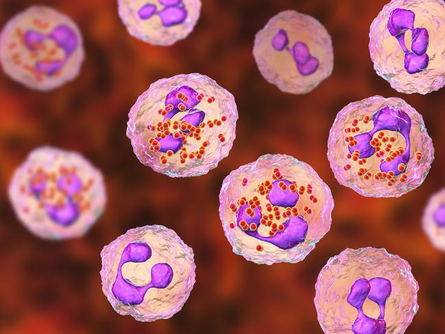 Meningococcal meningitis, cerebrospinal fluid smear containing neutrophils with and without bacteria Neisseria meningitidis, 3D illustration