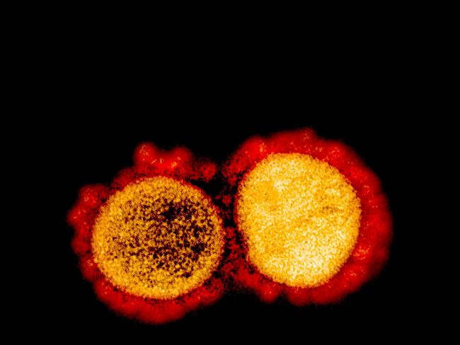 A transmission electron micrograph of SARS-CoV-2 virus particles, isolated from a patient in Eli Lilly trials.