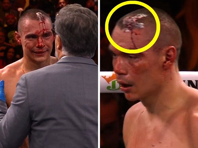 Questions are being asked about the head wound. Photo: Main Event.