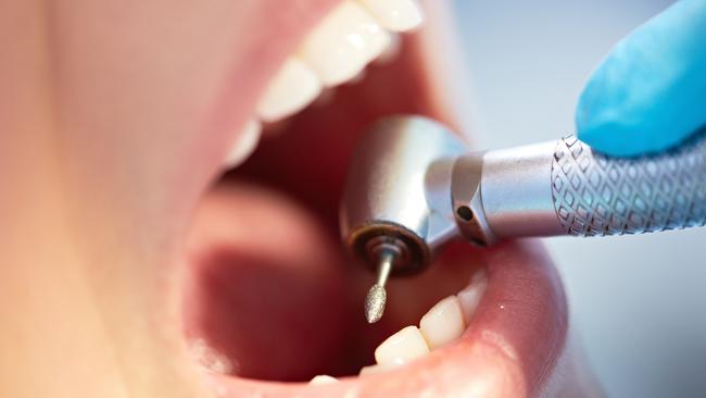 Research into prevention is key and is also needed to better understand the disease burden and to help turnaround the depletion of the public oral health workforce. Picture: iStock