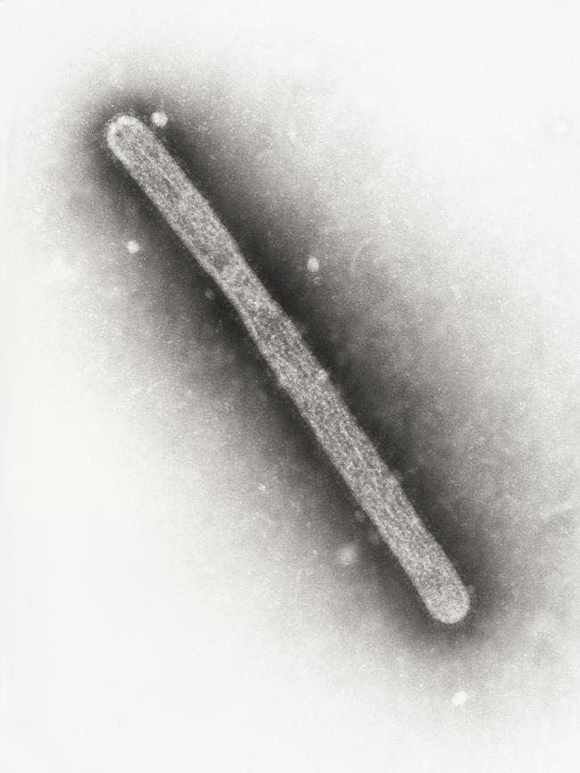 An avian influenza A (H5N1) virion, magnified. Picture: AFP