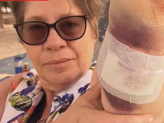 An elderly lady who was maulted by a dog in a vicious attack