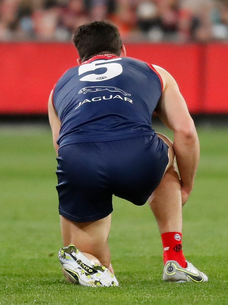 Petracca hairline fibula fracture. Picture: Michael Willson/AFL Photos