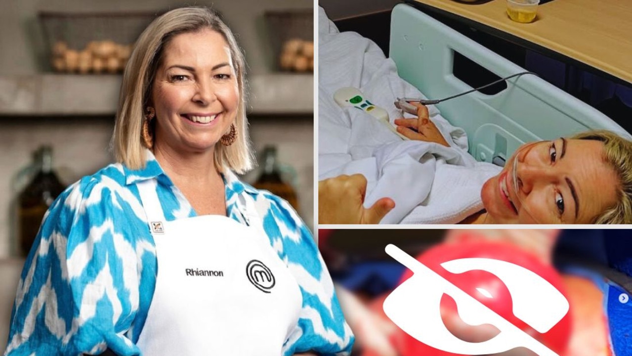 MasterChef star: ‘It wasn’t a baby, it was a melon-sized growth’