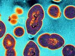 31/05/2005 PIRATE: Vancomycin resistant enterococci (VRE) bacteria, a life-threatening superbug as viewed under a microscope in 2005 image Pic. Supplied