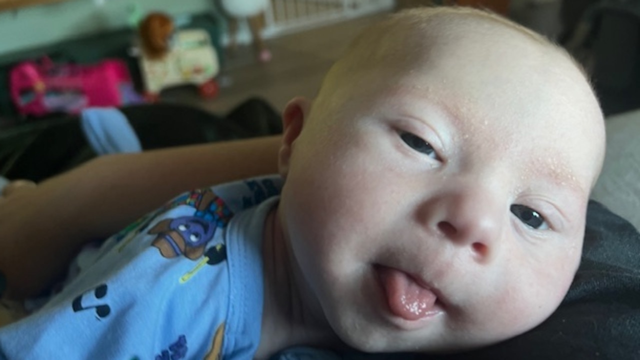 Baby Remi, who was born with down syndrome, is three months old and facing open heart surgery. Picture: Supplied by family