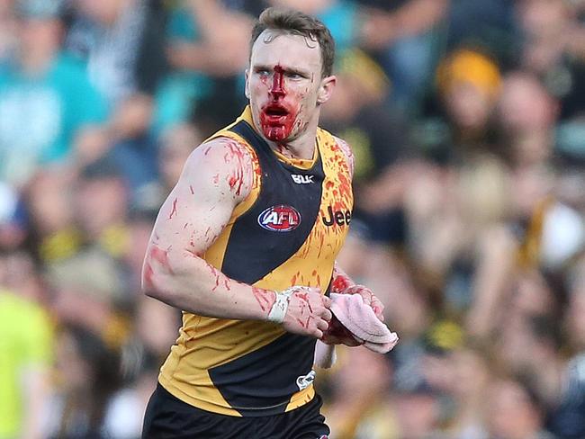 Nathan Foley leaves the field bloodied. Picture: Sarah Reed.