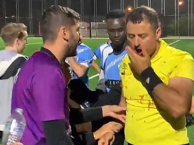 Khodr Yaghi was attacked while refereeing a game.