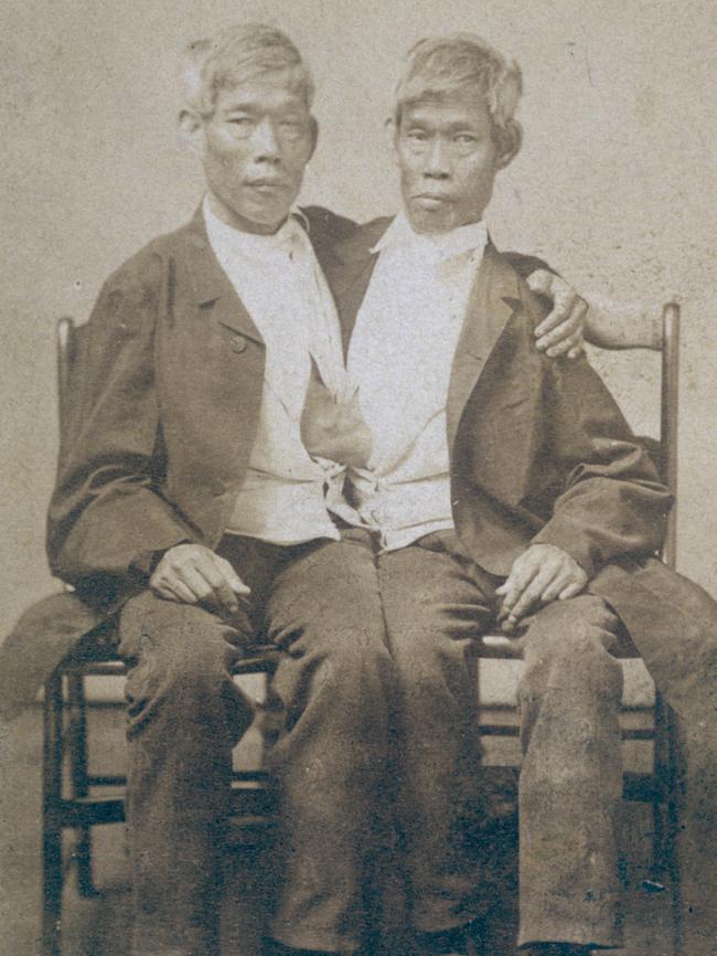 Chang and Eng Bunker (1811 — 1874) sitting on two wooden chairs circa 1865.