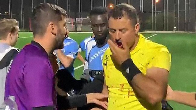 Soccer referee Khodr Ahmad Yaghi facing assault, grevious bodily harm charges