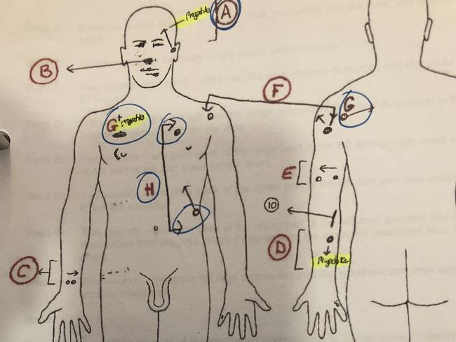 The injuries suffered by Mehmet Yilmaz that was presented to court.