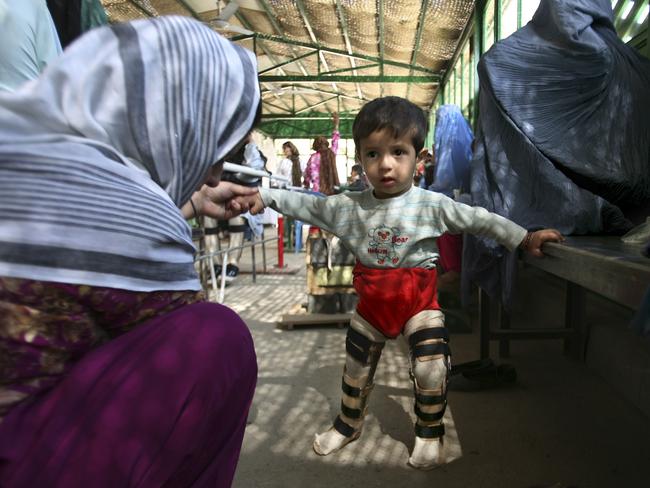 An Afghan child, suffering from polio, is helped by his mother.