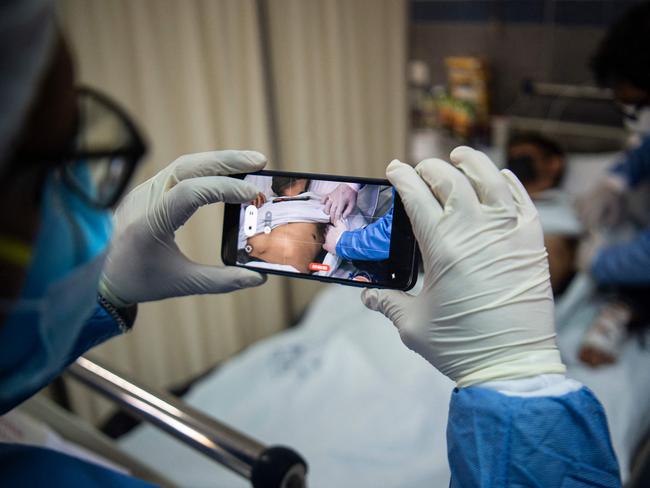 A doctor checks on a patient with sores caused by a monkeypox infection while another takes a picture, in the isolation area for monkeypox patients at the Arzobispo Loayza hospital, in Lima on August 16, 2022. - Nearly 28,000 cases have been confirmed worldwide in the last three months and the first deaths are starting to be recorded. (Photo by Ernesto BENAVIDES / AFP)