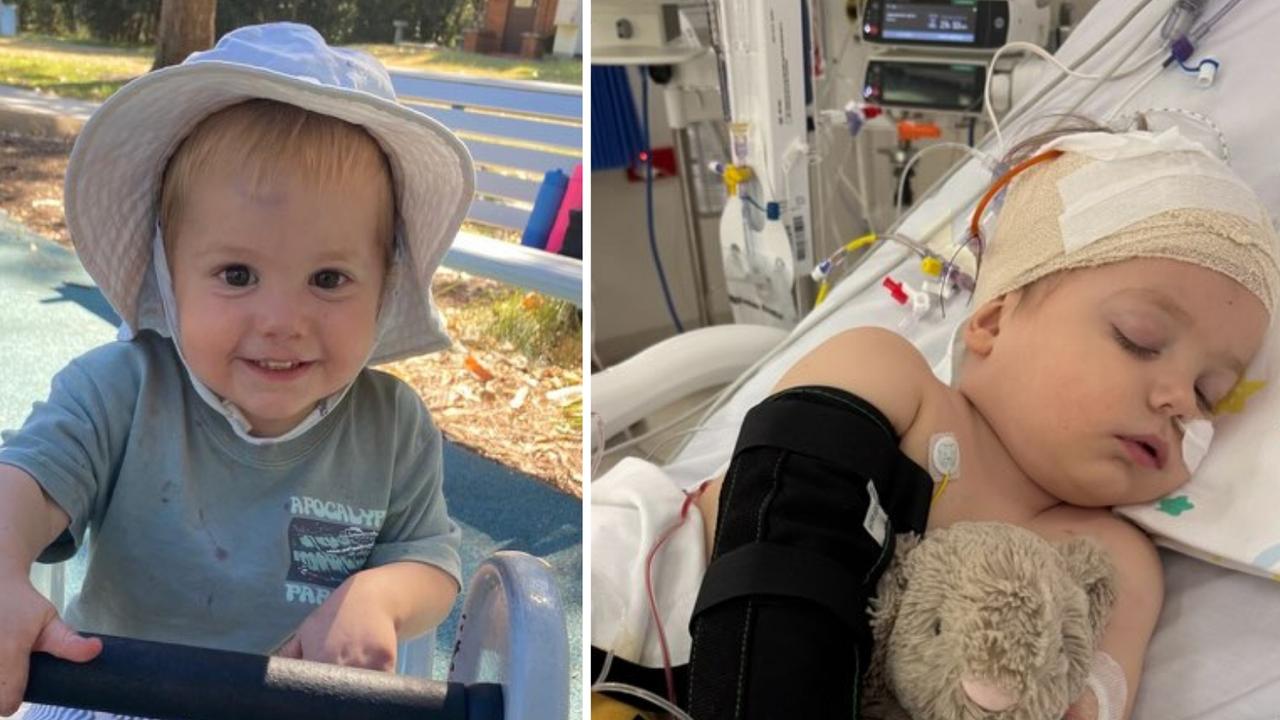 Darling Townsville toddler Flynn Pfoeffer is bravely battling back against all the odds after surgery for atypical teratoid rhabdoid tumour (ATRT), a rare and aggressive form of brain cancer that cruelly afflicts children aged under three years. Picture: Supplied