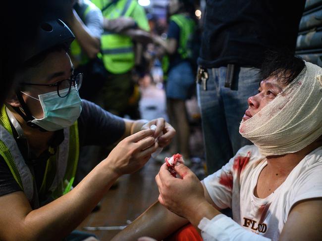 An injured man is attended to as he sits on the street after a clash during a protest in Tsuen Wan district of Hong Kong. Picture: AFP