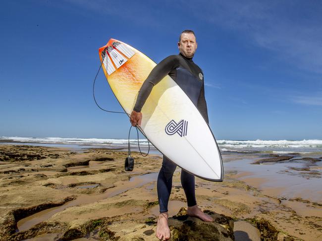 Mike Higgins was bitten at Port Campbell. Picture: Tim Carrafa