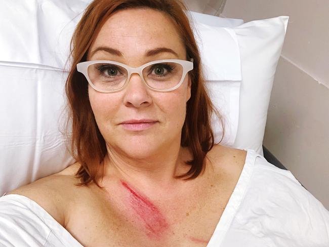 House Rules’ interior design expert Carolyn Burns-McGrave took this selfie in hospital after the accident. Picture: Supplied