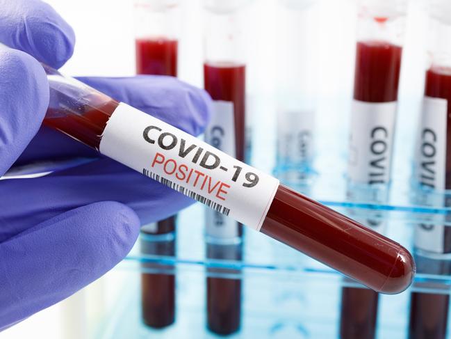 Close up of microbiologist hand with surgical gloves holding a positive blood test result for coronavirus. Test tubes rack with blood sample for covid-19 virus, on white background with copy space.