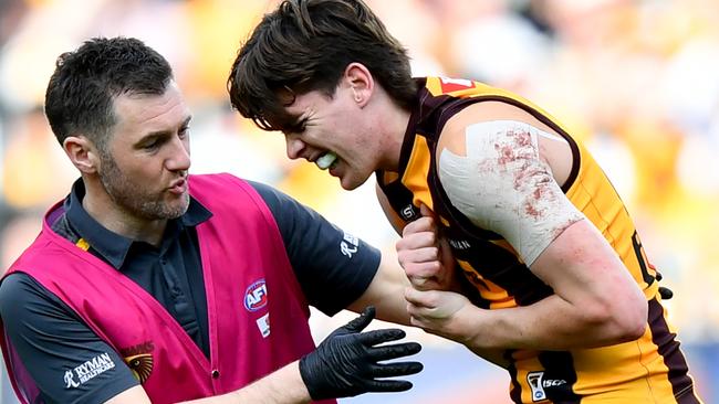 Hawthorn star Will Day will play as soon as he can handle the pain of an SC joint dislocation that does not require surgery. Picture: Josh Chadwick / Getty Images