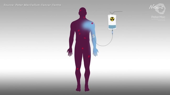 Breakthrough techniques for treating prostate cancer