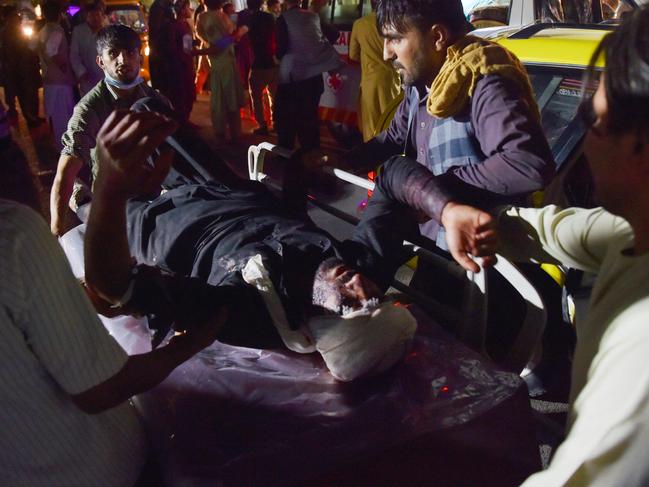 Medical and hospital staff bring an injured man on a stretcher for treatment after two blasts, which killed 100 people. Picture: AFP