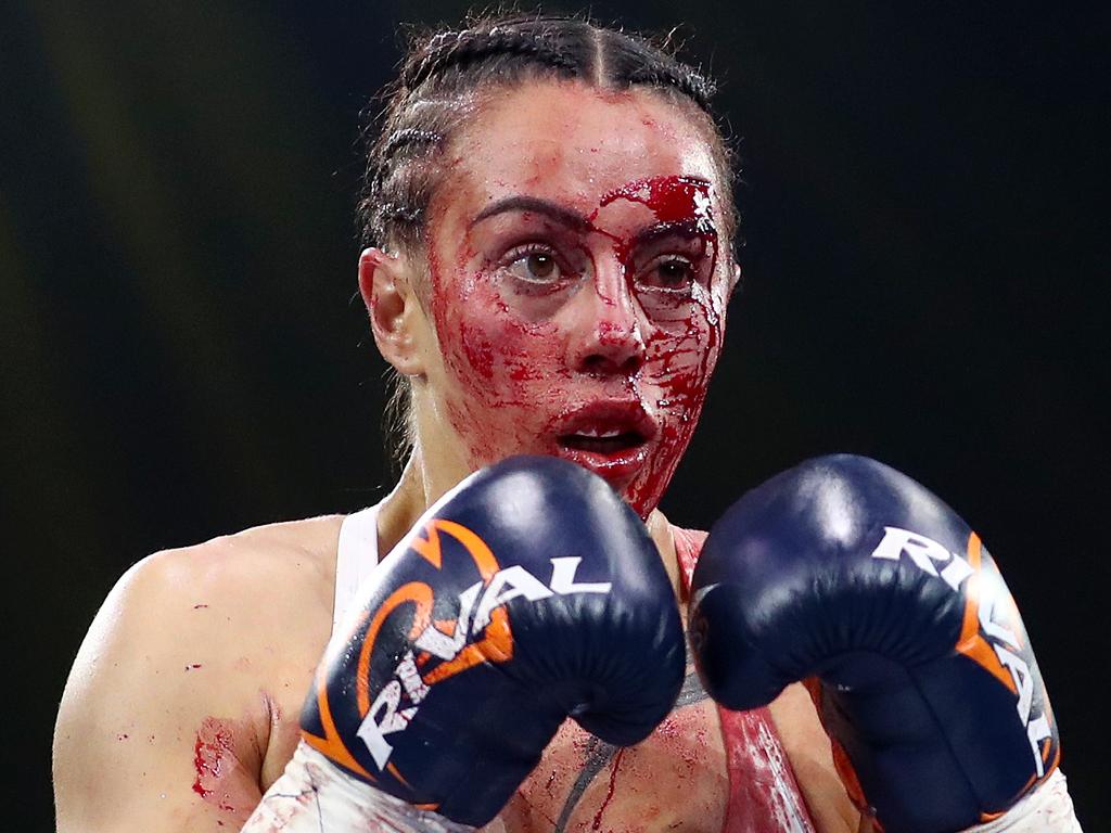 Johnson beat Ramadan despite the gruesome cut she suffered. Picture: Kelly Defina/Getty Images