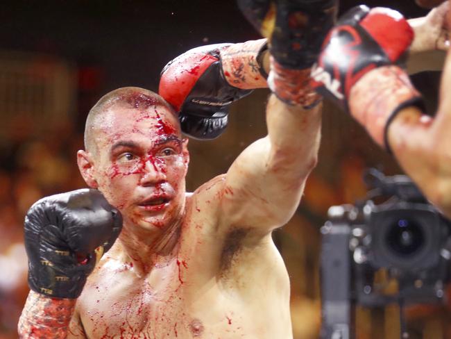 Tim Tszyu had a bloody fight against Sebastian Fundora in March. Picture: Getty Images