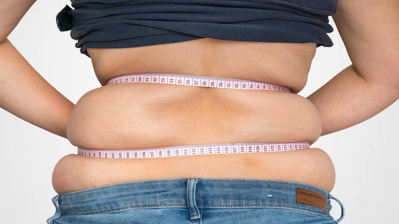 The obesity crisis has a ‘massive financial implication to the health system and to the economy’, Dr Gary Sacks says.