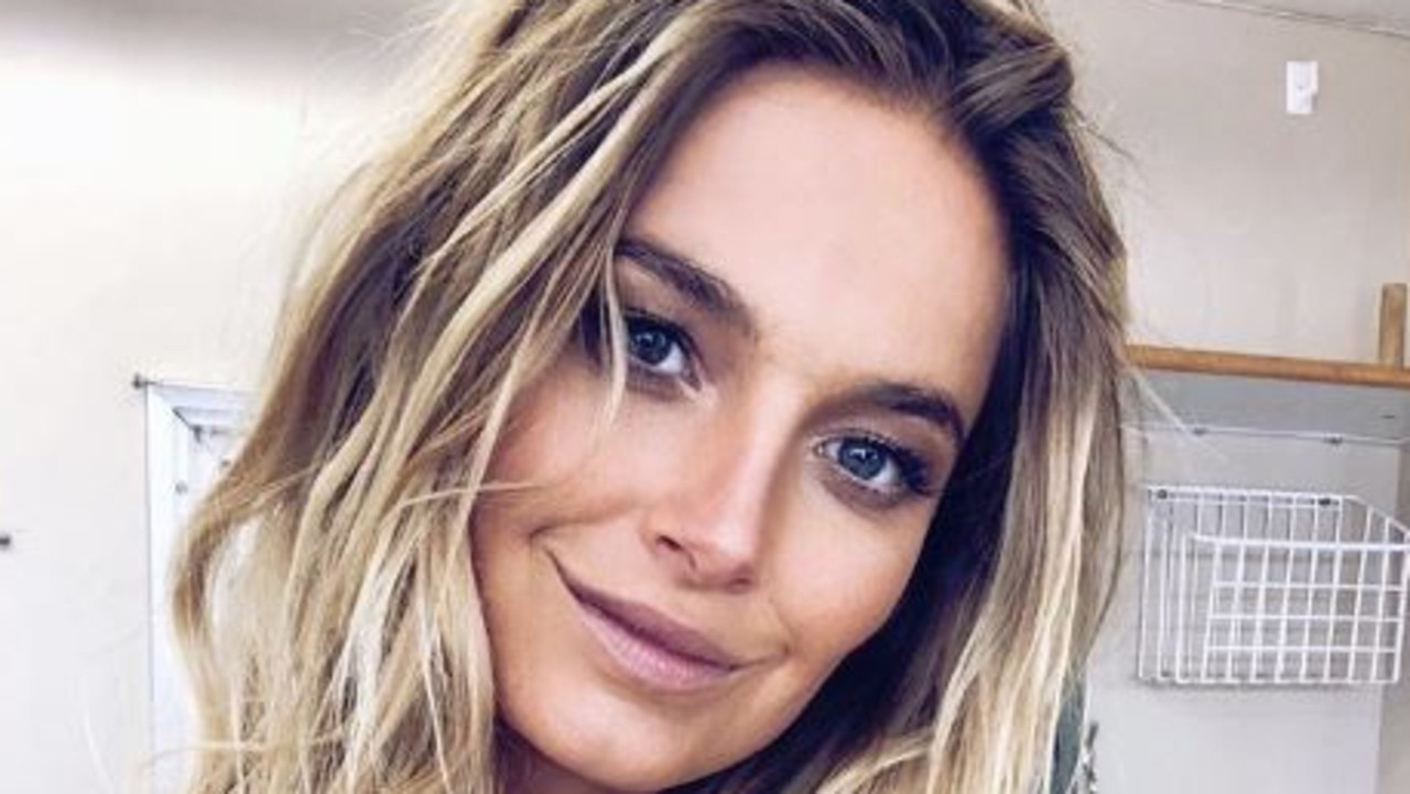 Australian model Bridget Malcolm has opened up about her physical and mental battles. Picture: Instagram