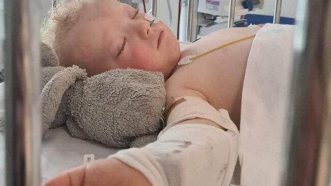 Leon Hobby, 1, needed a foot amputation and a blood transfusion after a freak mowing accident in Gympie on April 24. Â Picture: Supplied.