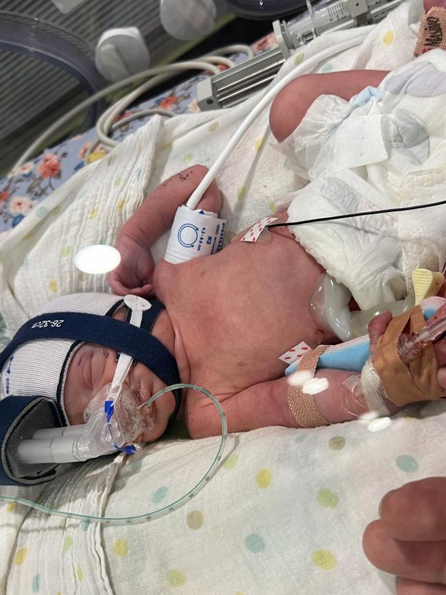 Born two months early only to then be struck down with a rare disease, twins Tilly and Mabel had a “traumatic” entry into the world. Picture: Supplied.