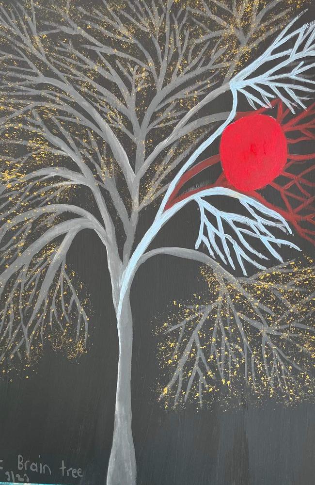 Rebecca's first artwork created in the first few weeks after her stroke, includes a red orb representing the part of her brain that the stroke took away.