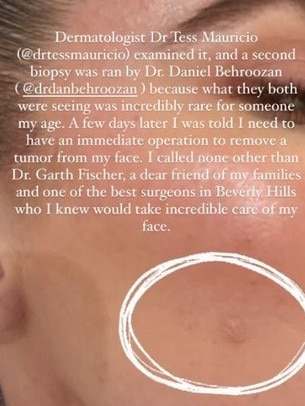 The 40-year-old said she initially assumed the bump was ‘something as minor as a zit’. Picture: Instagram