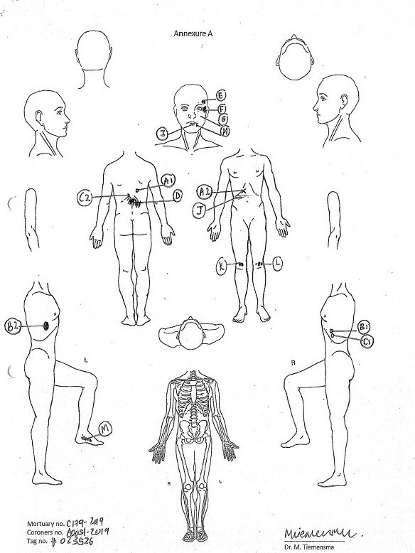 Autopsy diagram showing the positioning of bullet wounds to Kumanjayi Walker. Picture: Courts NT