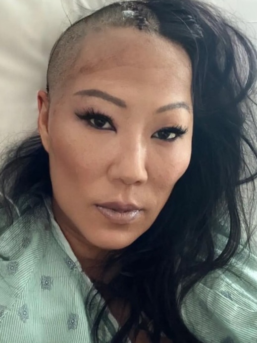 She’d undergone surgery after suffering a severe injury during a ski trip last month. Picture: Instagram