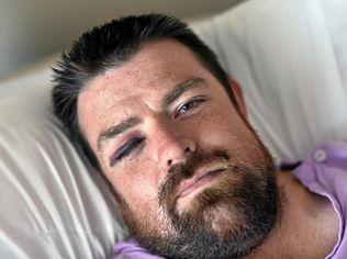 Josh was walking from Alex Surf club to watch the fireworks at Mooloolaba on New Years Eve when he was bashed in an unprovoked attack.