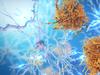 ‘Window of opportunity’ widens for Alzheimer’s sufferers