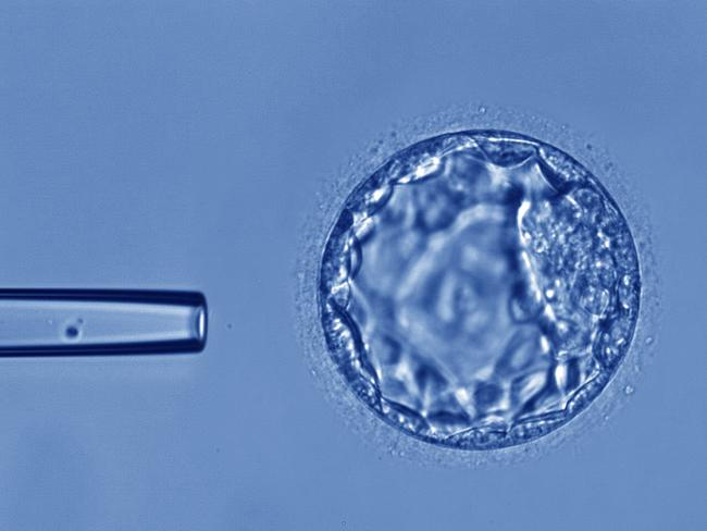 ‘Can’t afford IVF? Use super nest egg’