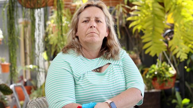 Nurse Karen Hoye had her thumb operated on via videolink, but now faces the prospect of permanent damage to her hand and no longer being able to work. Picture: Richard Dobson