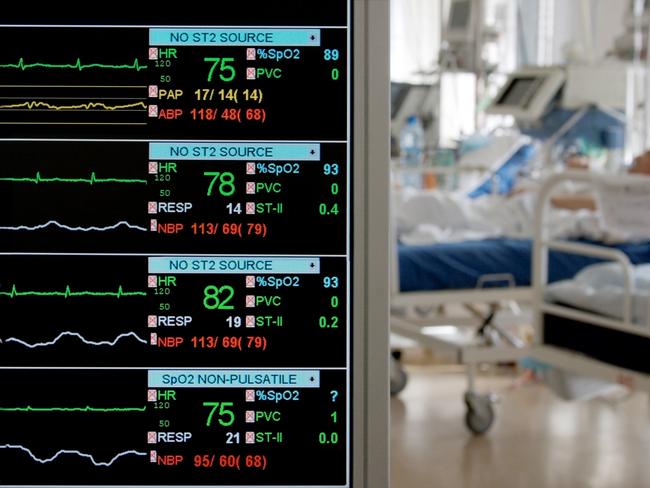 ORGANS  ..  generic photo of a heart rate monitor. Picture: iStock