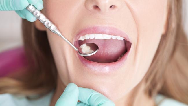 Having a regular dental check-up – and making sure your dentist knows that you are taking weight-loss medication – is important. Picture: iStock