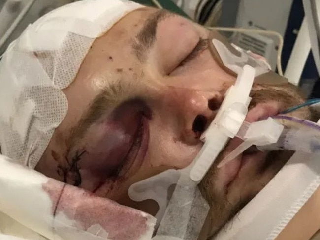 Joshua Penny was brutally assaulted at a Motel in Bendigo on January 2, leaving him with serious injuries. Picture: Contributed.