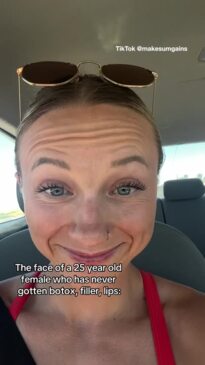 Woman trolled for looking old at 25