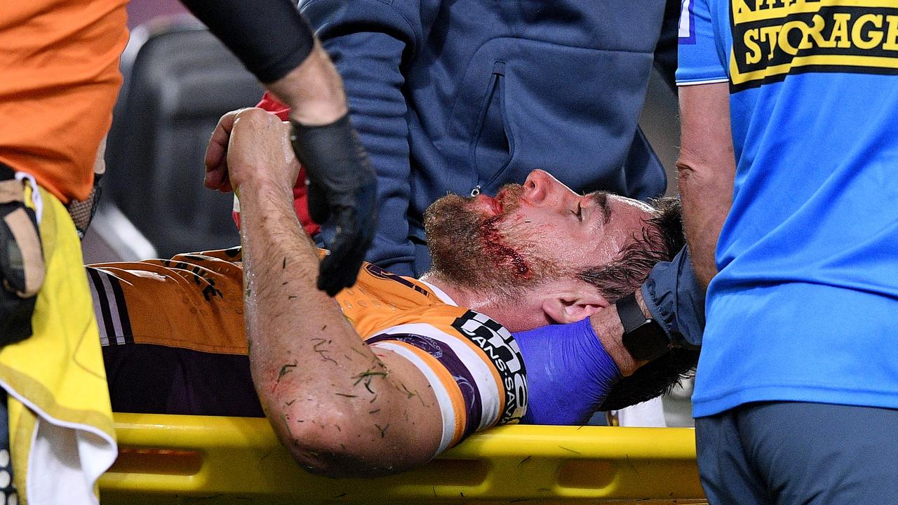 Andrew McCullough of the Broncos is stretchered from the field after an ugly hit from Dylan Napa.