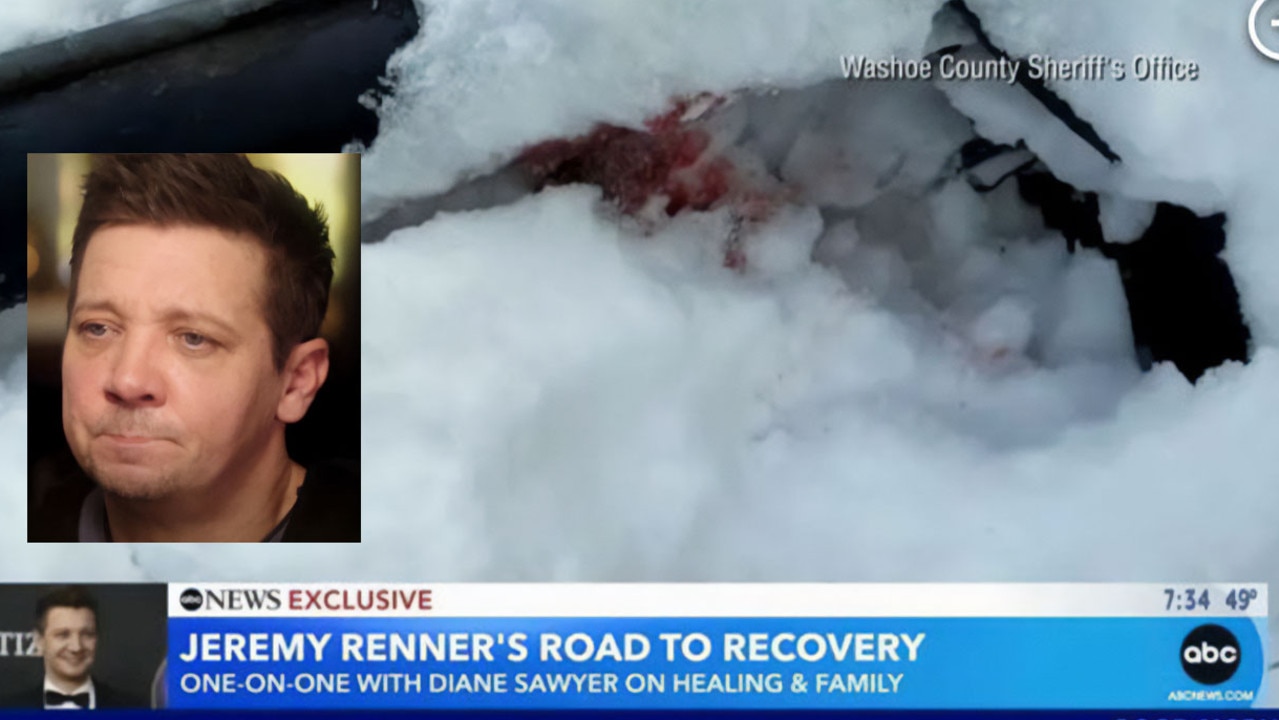 Jeremy Renner’s Bloody Snowplough Accident Photos Revealed | The ...