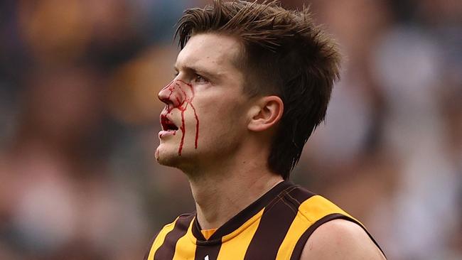 Mitchell Lewis cops an early blow against the Blues. Picture: Robert Cianflone/Getty Images