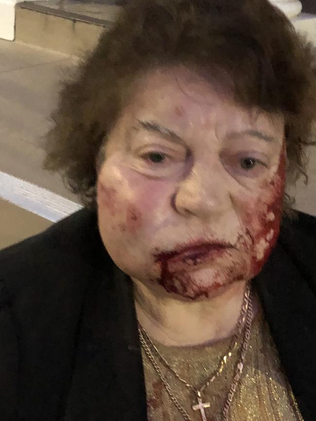 Penelope Katsavos was bashed in March 2021.