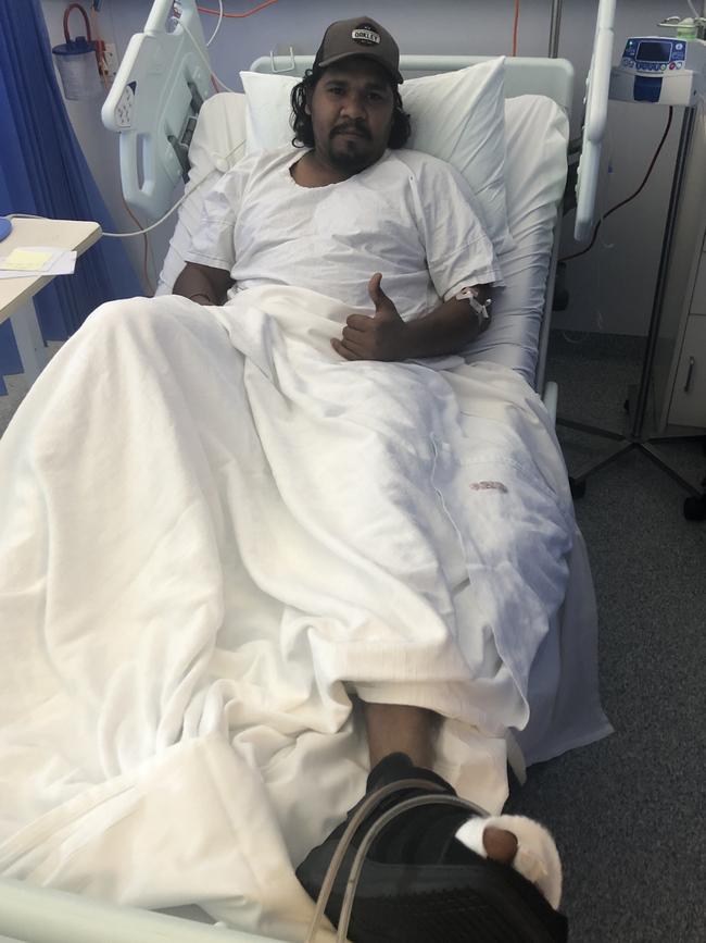 Leroy Daly is happy to have lived through a croc attack. Picture: Supplied