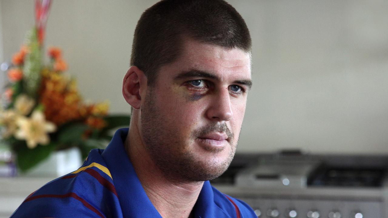 AFL: Jonathan Brown recalls horrific facial injury in 2011, footy rewind |  Herald Sun